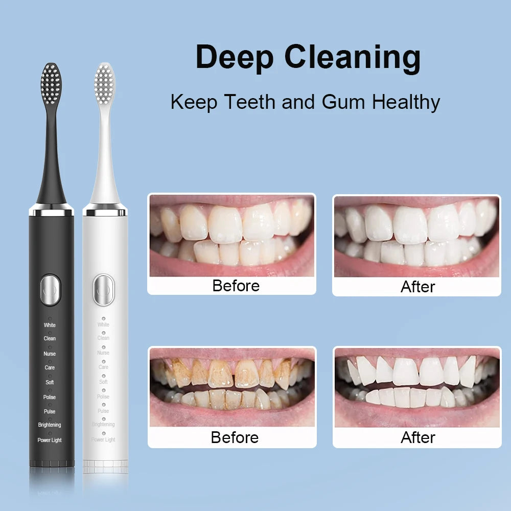 Mistify Glide™ Smart Electric Toothbrush